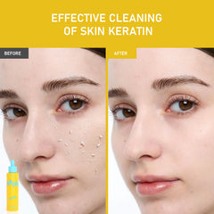 Papaya Enzyme AHA BHA Peeling Solution
